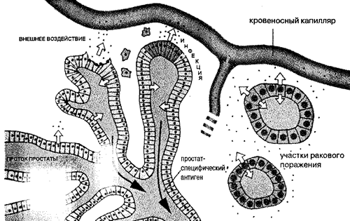Варианты циркуляции ПСА в организме человека