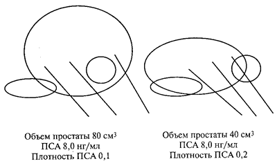 Влияние объема простаты на выявляемость рака
